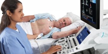 أشعة ايكو على القلب