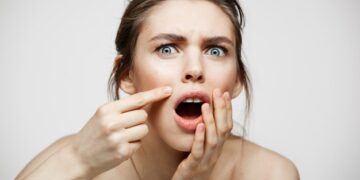 حبوب بعد إزلة الشعر