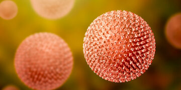 فيروس الحصبة