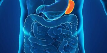 تضخم الطحال