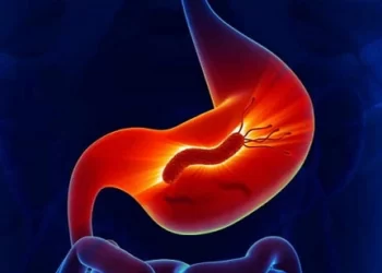 ما هي علامات الشفاء من جرثومة المعدة