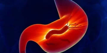 ما هي علامات الشفاء من جرثومة المعدة