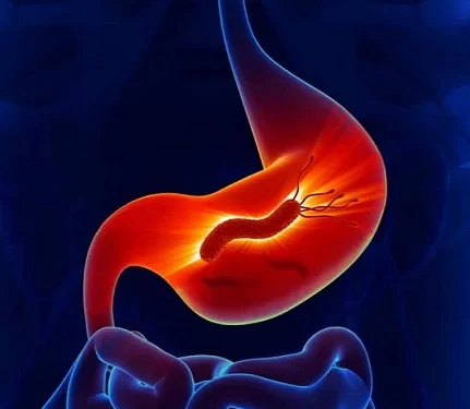 ما هي علامات الشفاء من جرثومة المعدة