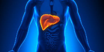 الإصابة بسرطان الكبد