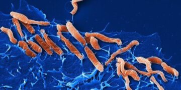 جرثومة المعدة