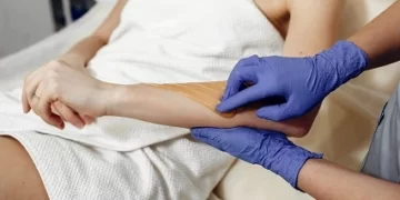 نمو الشعر تحت الجلد