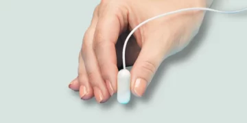 كبسولة المعدة الذكية