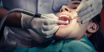 حشوتسوس الأسنان في المنزل