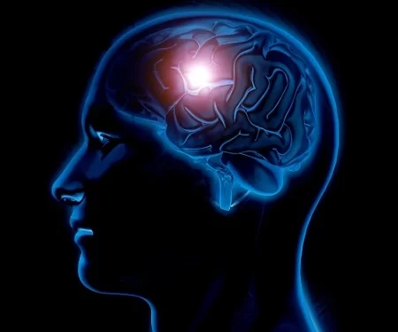 أعراض جلطة المخ