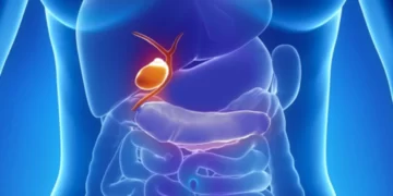 متى يجب تناول أملاح المرارة