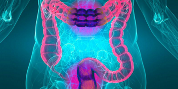 طريقة تنظيف القولون بالملح الإنجليزي