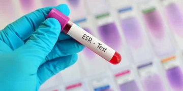 تحليل سرعة الترسيب