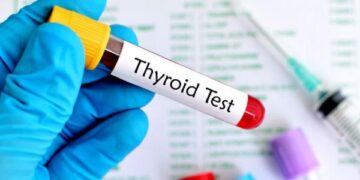 تحليل الغدة الدرقية